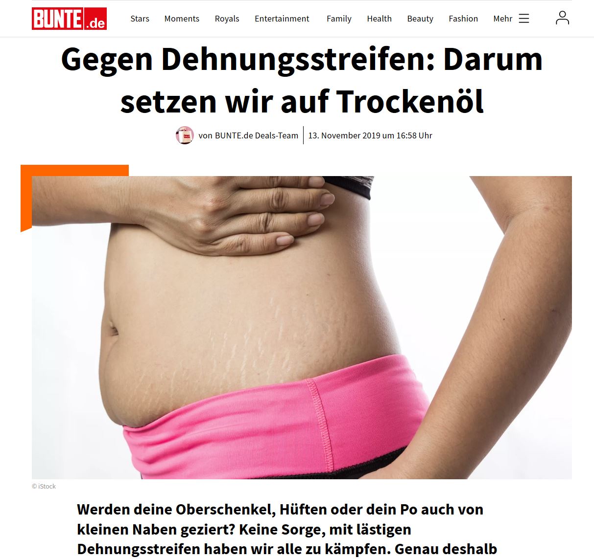 seitlicher Blick auf Bauch und Hüfte einer Frau. Sie zeigt ihre Schwangerschaftsstreifen.